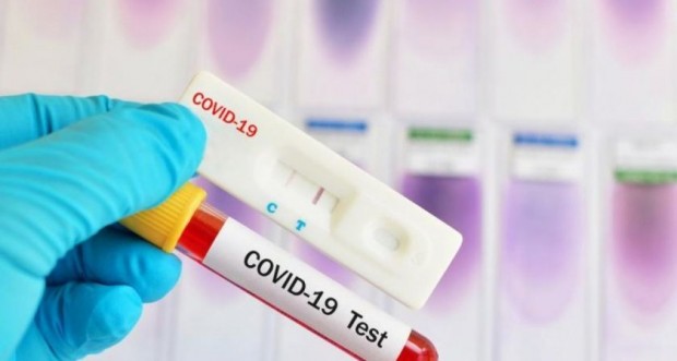 When can the COVID-19 test be wrong?