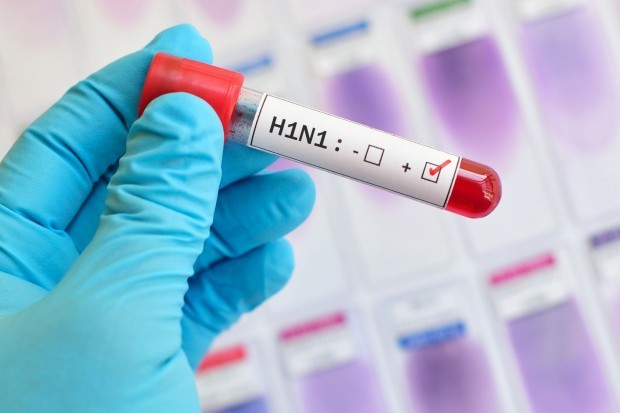 В Албания циркулира вирусът AH1N1 по известен като свински грип съобщава Институтът по