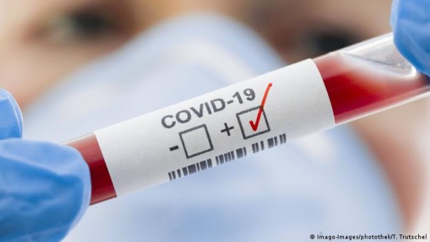3233 са новите случаи на коронавирусна инфекция, 151 души са  починали,