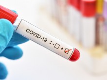 728 нови случая на COVID-19 у нас