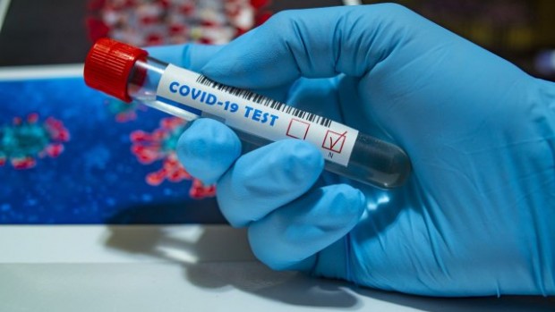 2681 са новите случая на заразяване с коронавирус. Това сочат