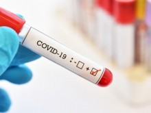 985 са новите случаи на Covid-19, Пловдив вече не е в челната тройка по брой заразени