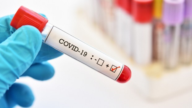 985 са новите случаи на коронавирус у нас. 80% от