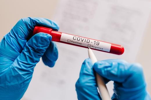 През денонощието в страната са регистрирани 7263 нови случая на коронавирусна инфекция, показват