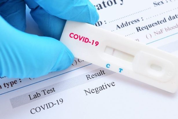 Преболедувалите COVID 19 да си направят изследване на урината съветва