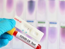 313 са новините случаи на COVID-19, от тях 22 в Пловдив