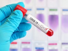 121 са новите случаи на COVID-19, в Пловдив са само 5