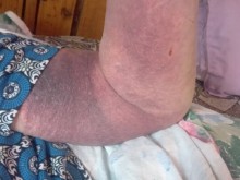 Възрастна жена твърди, че е връзвана, душена и мачкана в болница