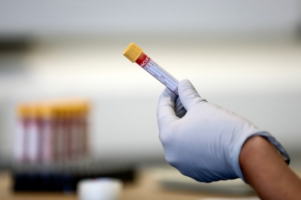 314 са новите случаи на коронавирус пред последното денонощие, показват данните