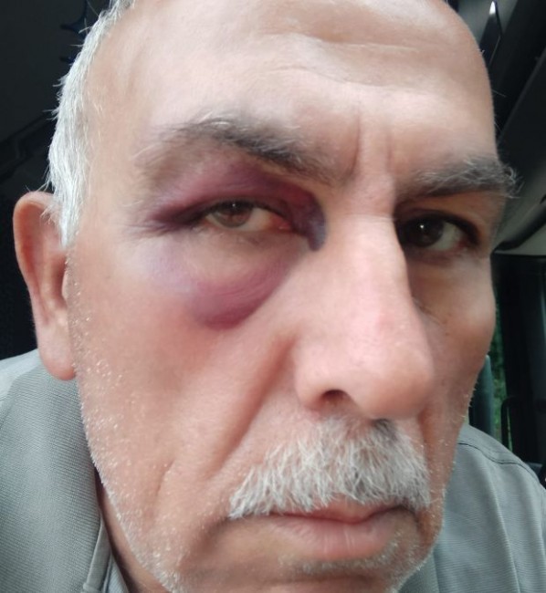 Български тираджия наби турски колега в района на Видин, пострадалият