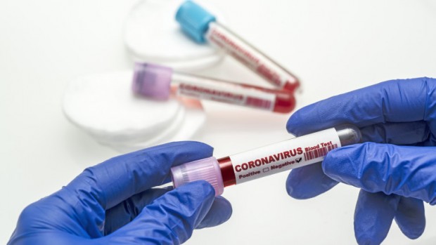 Новите случаи на заразени с коронавирус са 1640 за последното денонощие