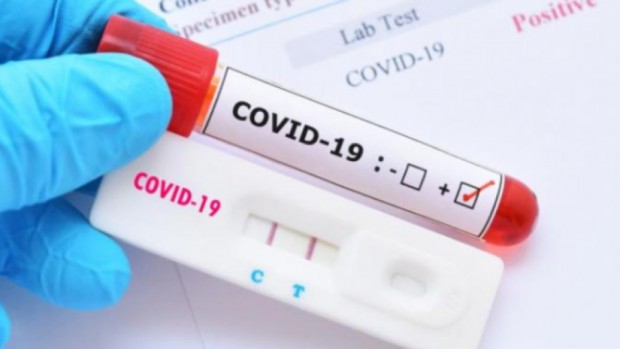 2987 са новите случаи на заразени с COVID 19 за