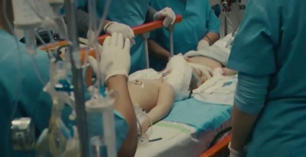 Сиамски близнаци в Бразилия бяха успешно разделени след 27 часова операция