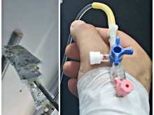 Оперираха по спешност бивш депутат от "Има такъв народ", бил е на косъм от смъртта
