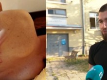 22-годишен твърди, че е бит от полицаи