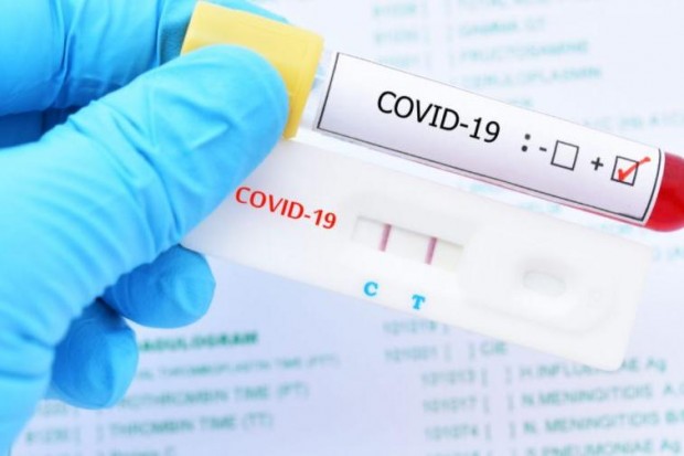 ��� 20% �� ����������� ������� �� COVID-19 ���� ���������� ��������� �� �����������