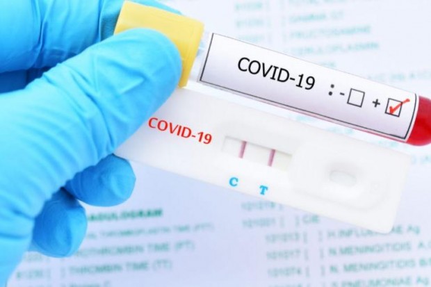 Новите потвърдени случаи на коронавирус  са 420 сочат данните на Единния