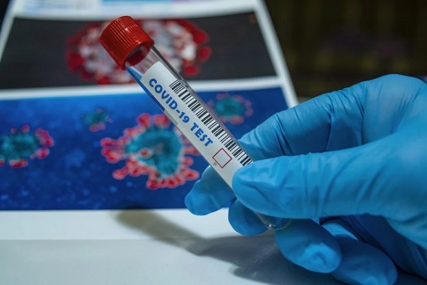 2 289 са потвърдените случаи на коронавирус в България през изминалото денонощие