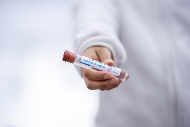 ТАСС: В Русия намалиха срока на валидността на PCR теста от 72 на 48 часа