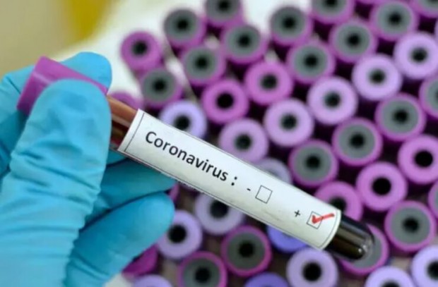 Новите случаи на коронавирус у нас за последните 24 часа са 777