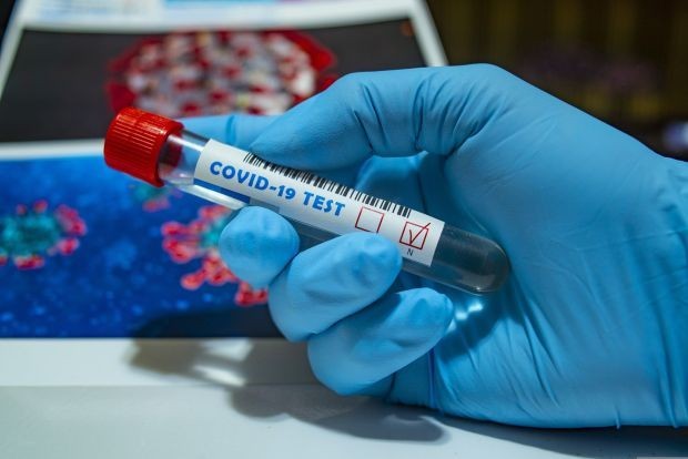 TD 288 са новите случаи на коронавирус у нас Направени са 1