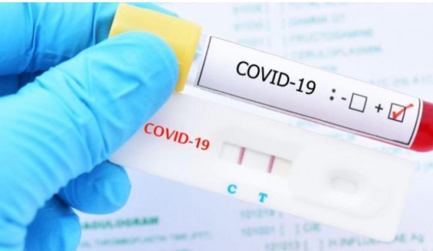 183 �� ������ ������ �� COVID-19, � ����� �� 59