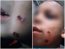 Какво се случи с родителите, които показаха едно от децата си с изгаряния от цигара по лицето и тялото?