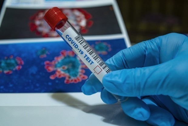 </TD
>Новите потвърдени случаи на коронавирус у нас за последното денонощие