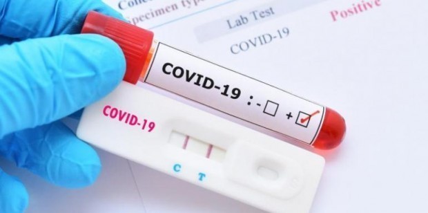 25 са новите случаи на коронавирус, двама са починали