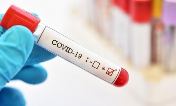 150 �� ������ ������ �� COVID-19, � ����� �� 46