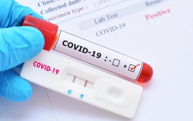 135 �� ������ ������ �� COVID-19 � ���, � ����� �� 47