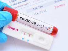 59 са новите случаи на COVID-19 у нас