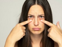 Как да се отървем от тъмните кръгове под очите? 