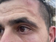 Биха го в присъствието на бременната му приятелка