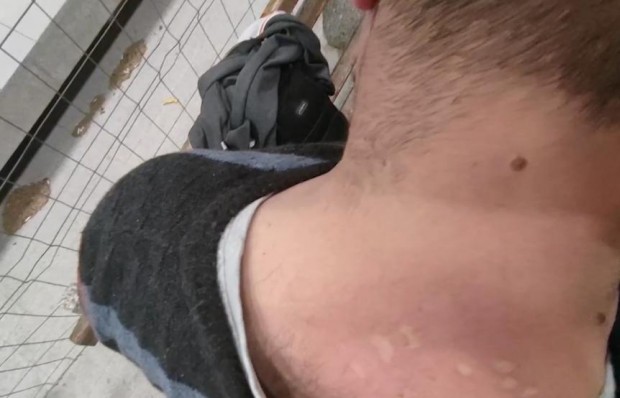 Мъж беше нахапан от дървеници във влака, БДЖ извършва проверка