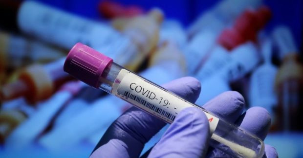 43 са новите случаи на коронавирус у нас за последното денонощие