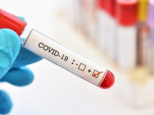 ��������� �������� ���� ������ �� ����������� ��� COVID-19