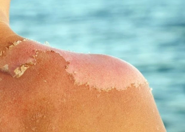 ����� �������� �� ������� ������� �� ���������� ��������