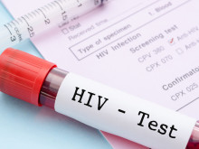 32 са новите ХИВ-позитивни лица във Варна