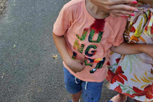 </TD
>Дете си сцепи главата на занемарена детска площадка в Бургас. Дете
