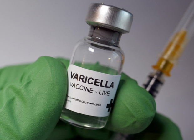 С една-пета са се повишили заболелите с варицела във Варненско