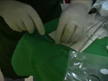 Болни от цялата страна идват за безкръвни урологични операции в Пловдив