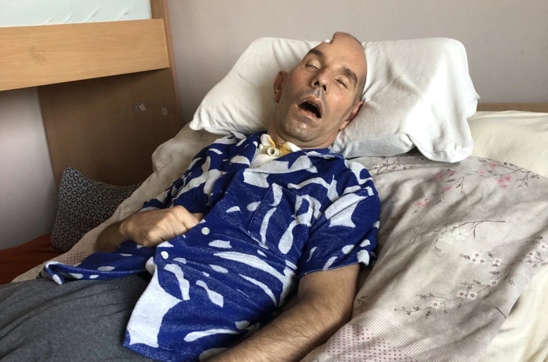 Половината глава на Христо я няма, за лекарите в България не е жив, но въпреки това за него има надежда