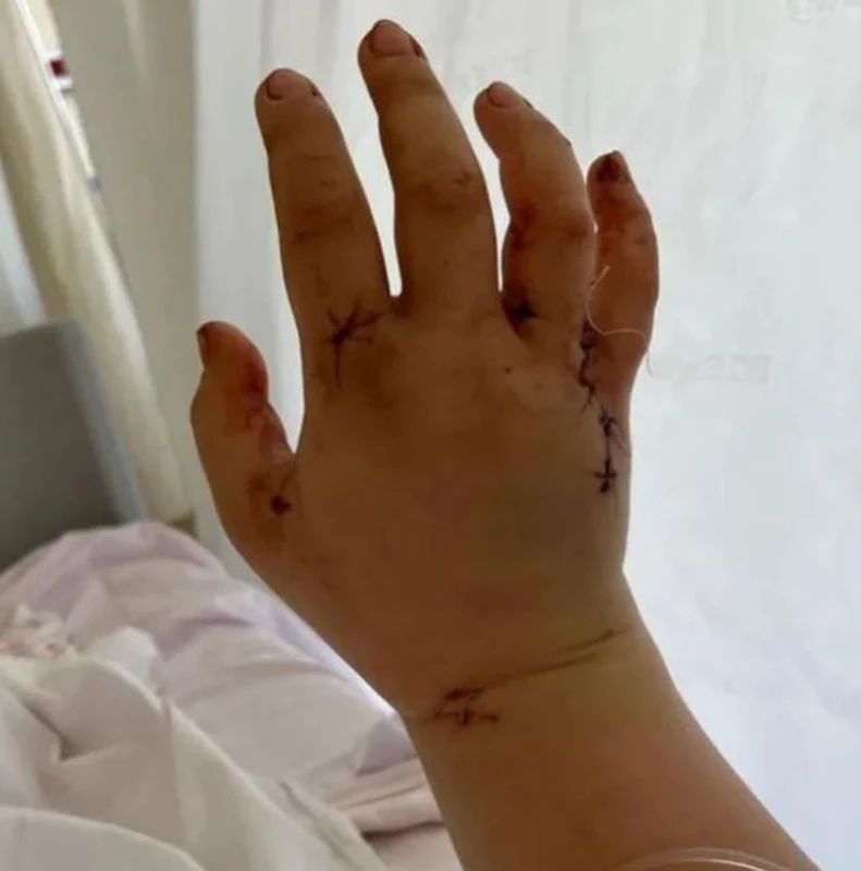 Мъж прободе съпругата си с нож над 30 пъти, по чудо тя оцеля