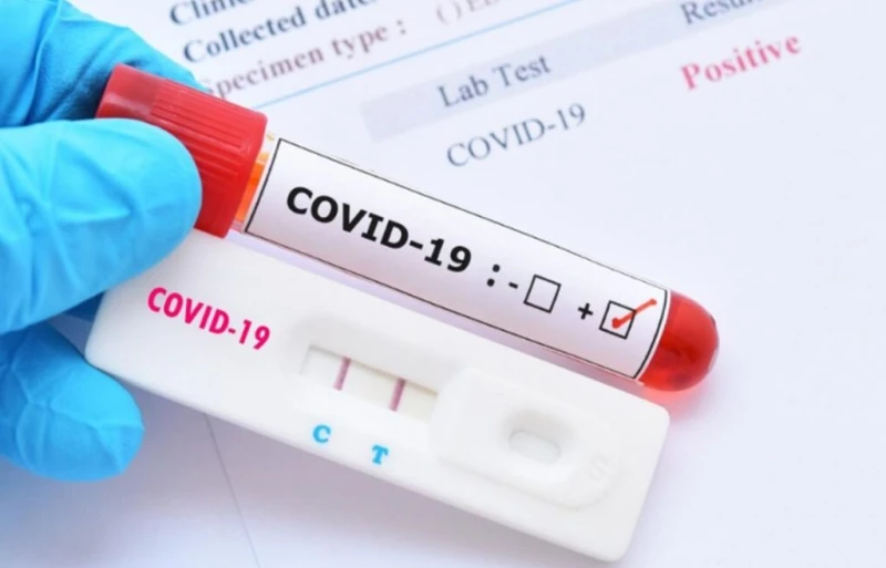 ����������� � �������� � ��������� �� COVID-19 � ���������� ��-������ �� ����������
