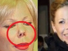 Калина жертва на жестока лекарска грешка