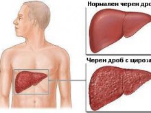 Необезопасен секс и злоупотреба с алкохол скъсяват живота