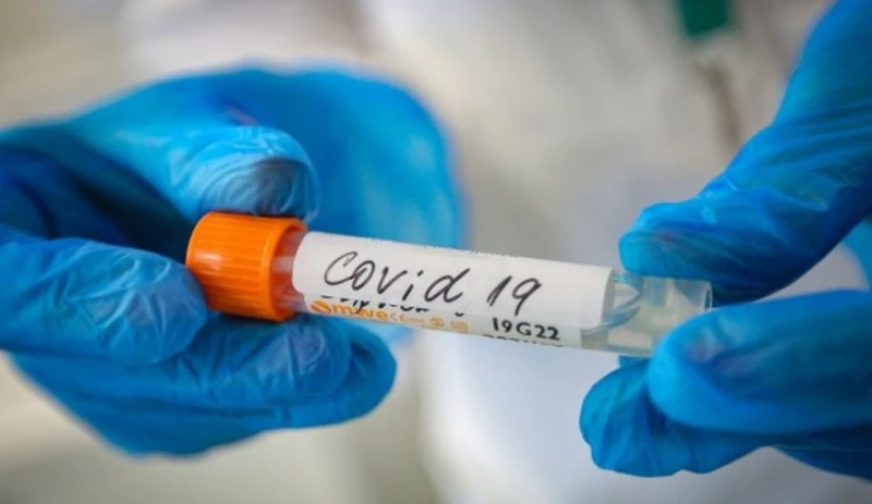 ���� � �������� �� COVID-19 �� ���������� 24 ����