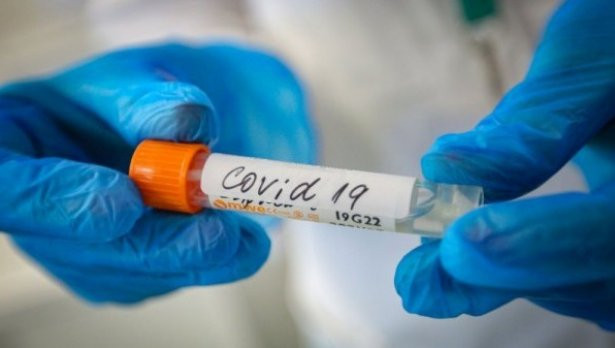 TD 296 са новите случаи на коронавирус у нас Направени са