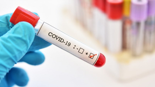 </TD
>87 са новите случаи на коронавирус у нас. Направени са 477